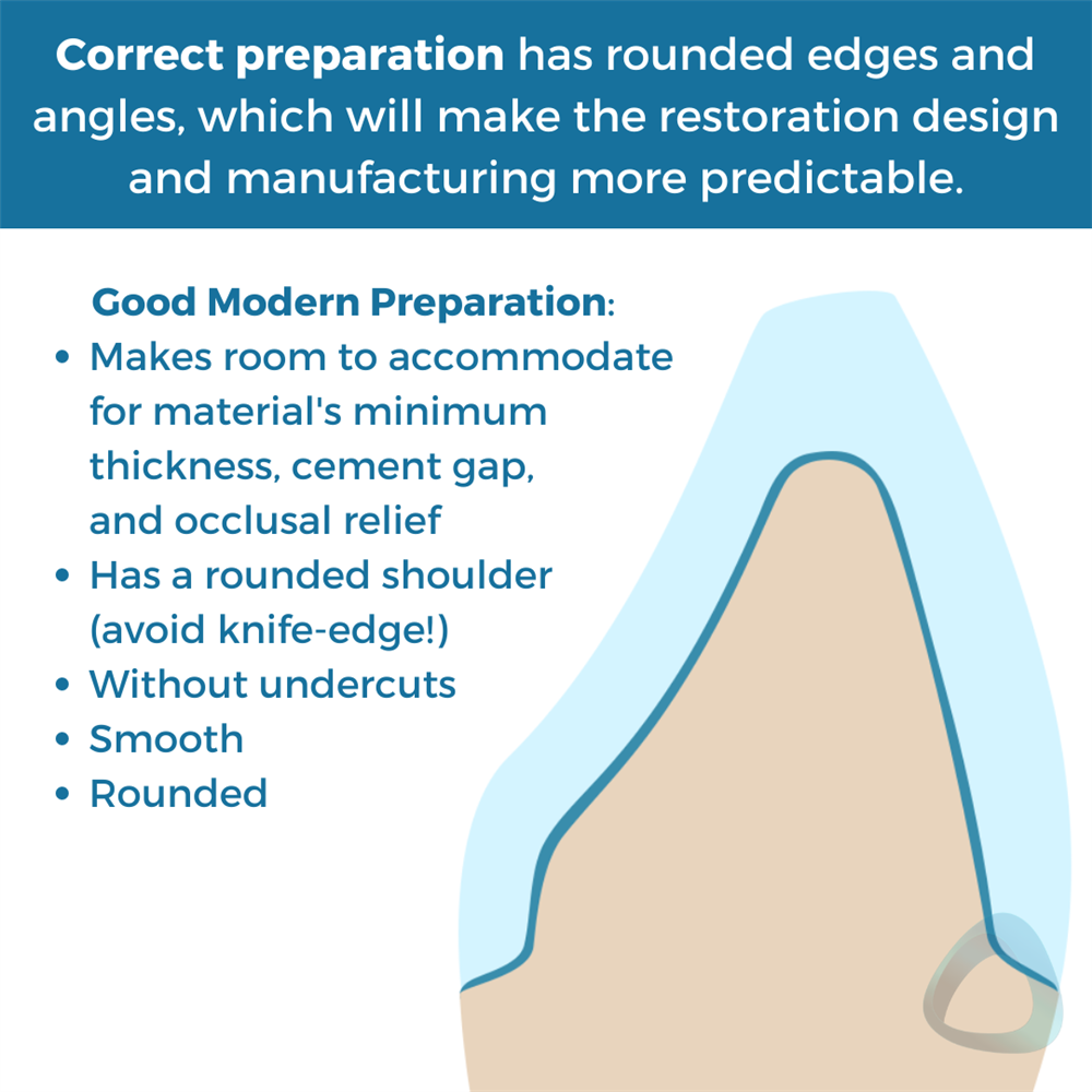 Tooth preparation design diagram