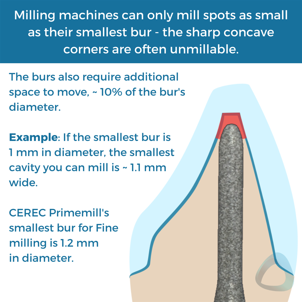 Tooth preparation design diagram