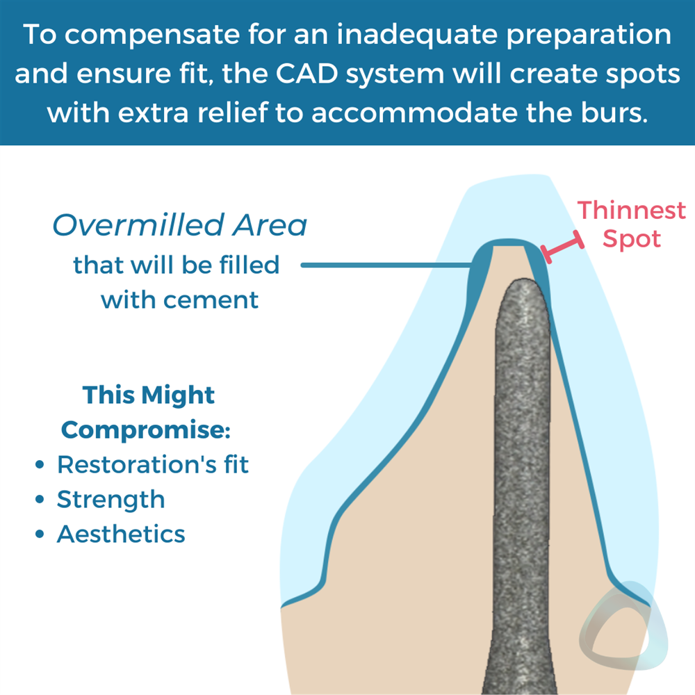 Tooth preparation design diagram